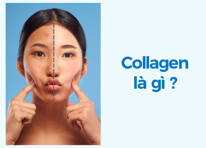 collagen-la-gi